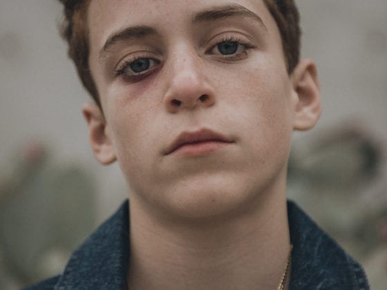 An upclose photo of a teen boy's face