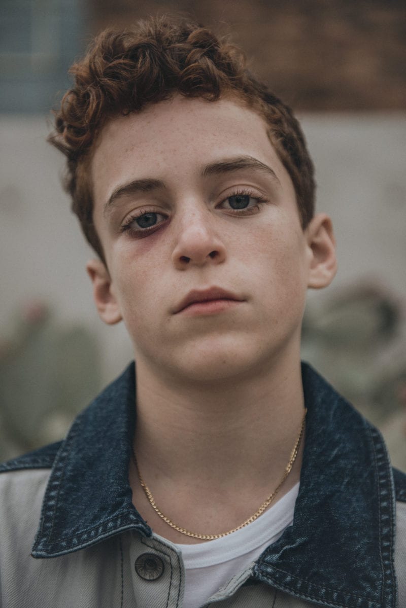 An upclose photo of a teen boy's face